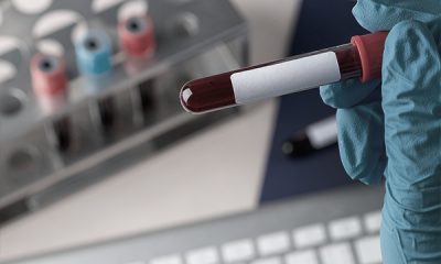 trt-labwork